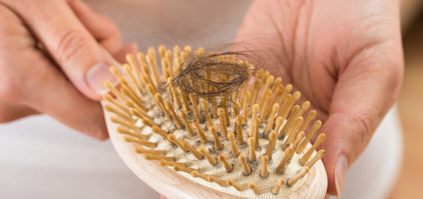 Person Hand Holding Comb With Loss Hair